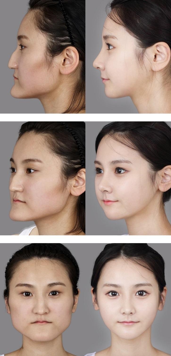 컨텐츠 이미지