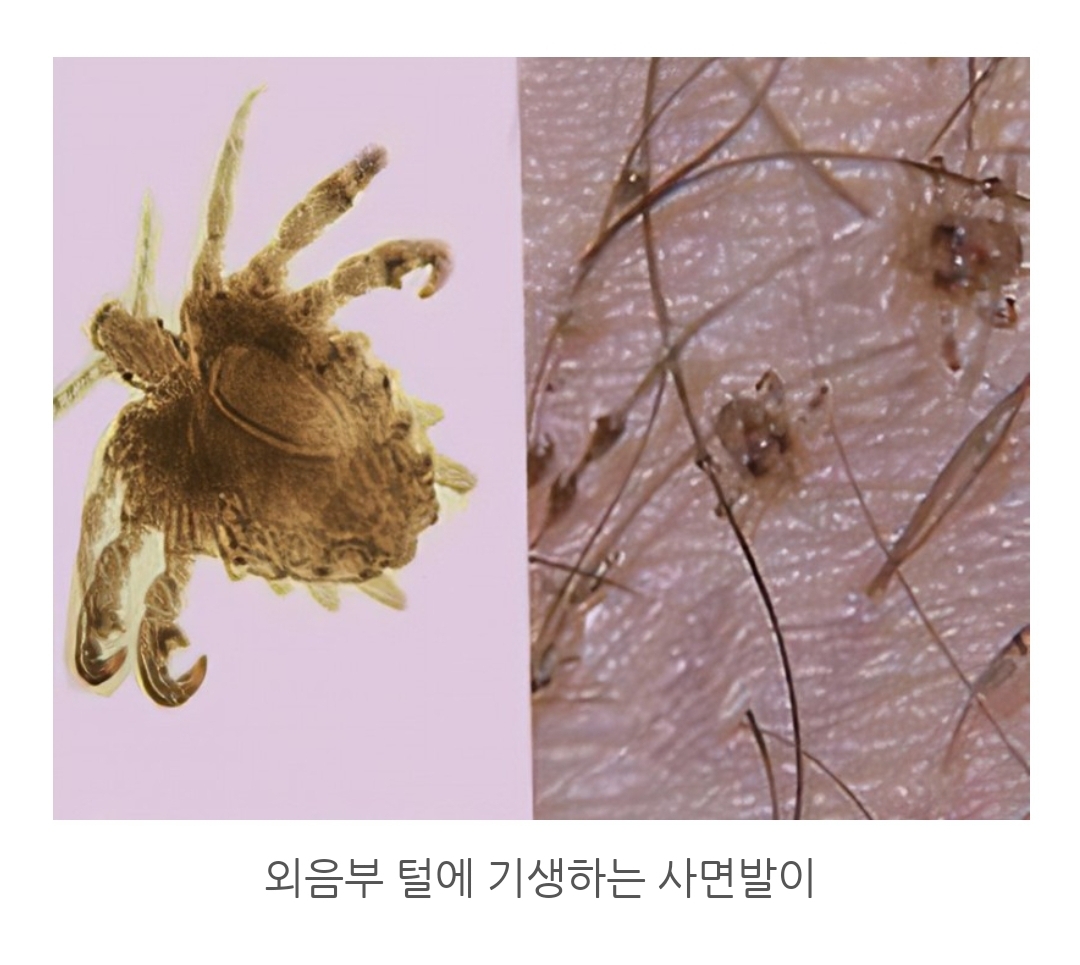 첨부파일