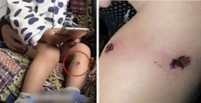 이스라엘이 나치를 뛰어넘었다고 생각한 사건중 하나