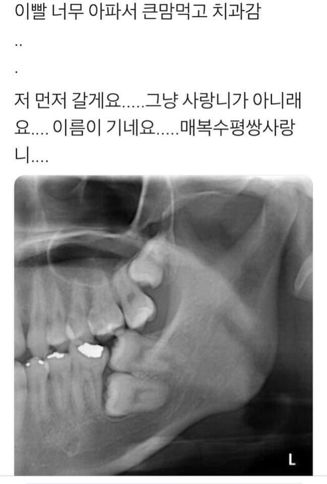 첨부파일