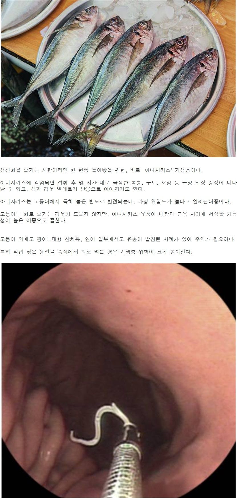 기생충 감염 위험 1위 생선001.jpg