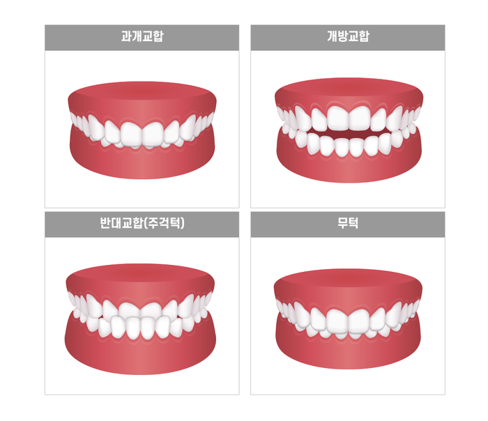 첨부파일