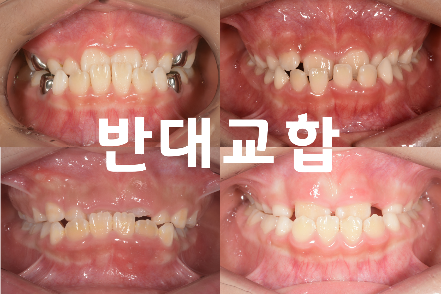 첨부파일