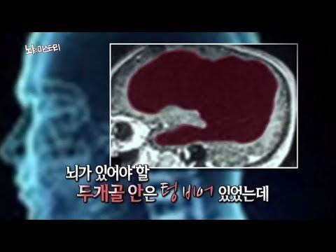 첨부파일
