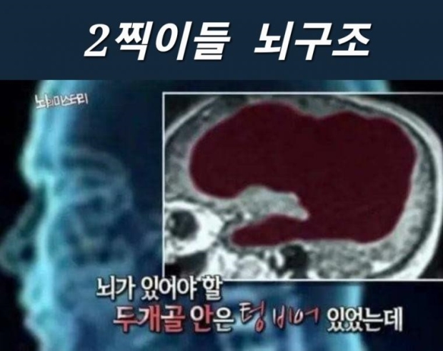 2찍이 짤들 (4).jpg